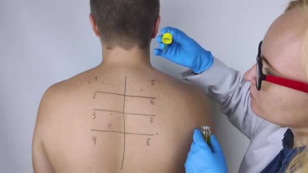 Een Allergist Het Laboratorium Doet Een Allergie Prik Test Huidtest — Stockvideo