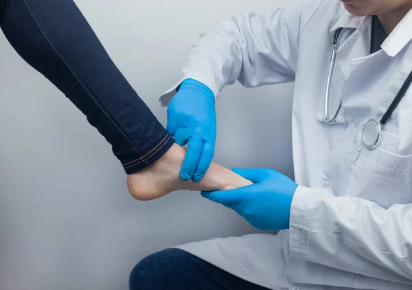 Ортопед Хирург Осматривает Ногу Женщины Боль Ногах Сухожилия Воспаление Плоские — стоковое фото
