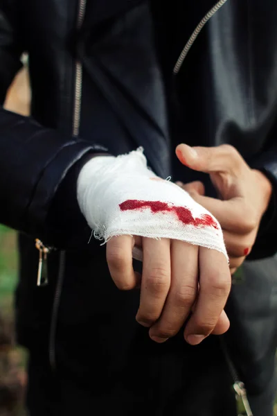 Man Bandage Blood Knuckles Natural Background End Fight Fight Blood — ストック写真