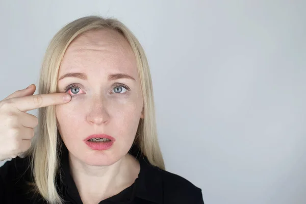 Uma Mulher Esfrega Seus Olhos Cansados Com Mãos Fundo Branco — Fotografia de Stock