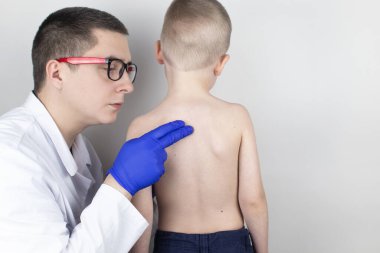 Doktor randevusunda sırt ağrısı olan küçük bir çocuk. Omurga deformasyonu ve boyun eğme tedavisi. Kemik erimesi, kifoz, lordosis veya skolyoz..