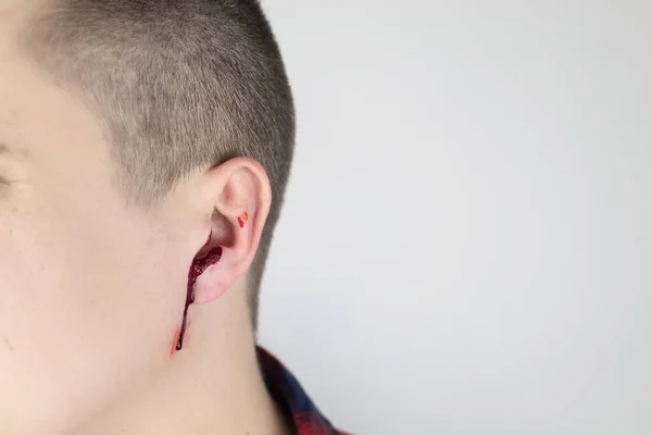 Hombre Cuyo Oído Está Sangrando Ruptura Vascular Daño Membrana Timpánica — Foto de Stock