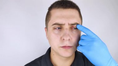 Doktor, kanaması olan bir hastayı muayene ediyor. Göz kapağının kızarıklığı ve iltihap tedavisi. Gözlerin etrafındaki deri enfeksiyonu. Kaliteli tıbbi bakım konsepti