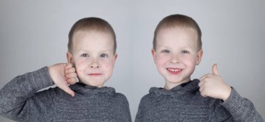 Önce ve sonra. Çocuğun yüzünde kırmızı alerjik sivilceler var. İkinci resim, alerjisi olmayan temiz bir yüzü gösteriyor. Çocuk döküntülerinin tedavisi konsepti. Suçiçeği