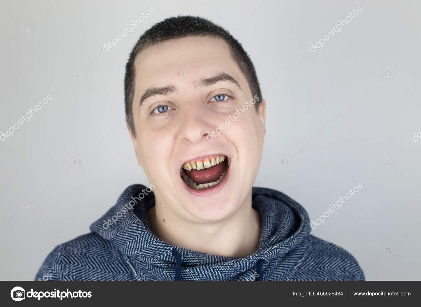 Man Has Rotten Teeth Teeth Fell Out Yellow Black Teeth Stock Photo by  ©Alena1919 455926484