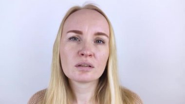 Bir kadın dudaklarındaki kuru deriyi inceliyor. Soyulma, kabalaşma, rahatsızlık, cilt hassasiyeti. Dermatolog ya da kozmetikçinin randevusundaki hasta. Kuru deri parçalarının yakın çekimi