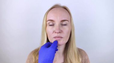 Bir kadın dudaklarındaki kuru deriyi inceliyor. Soyulma, kabalaşma, rahatsızlık, cilt hassasiyeti. Dermatolog ya da kozmetikçinin randevusundaki hasta. Kuru deri parçalarının yakın çekimi