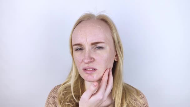 Egy Száraz Bőrt Vizsgál Arcán Peeling Durva Kellemetlen Érzés Bőrérzékenység — Stock videók