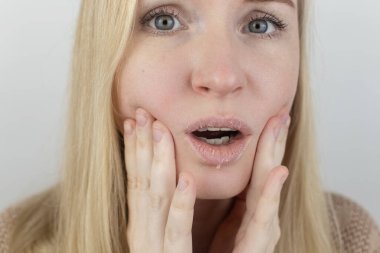 Bir kadın dudaklarındaki kuru deriyi inceliyor. Soyulma, kabalaşma, rahatsızlık, cilt hassasiyeti. Dermatolog ya da kozmetikçinin randevusundaki hasta. Kuru deri parçalarının yakın çekimi