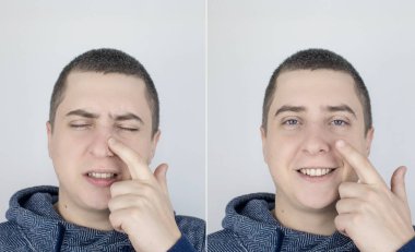 Önce ve sonra. Soldaki adam burun ağrısını gösteriyor, sağdaki de burnun artık ağrımadığını gösteriyor. Profesyonel tıbbi yardım kavramı. Alerji ve burun kanamalarının tedavisi