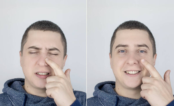 До и после. Слева мужчина указывает на боль в носу, а справа на то, что нос больше не болит. Концепция профессиональной медицинской помощи. Лечение аллергии и кровотечений из носа