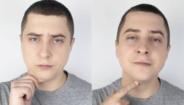 Çift çene gerdirme. Estetik ameliyattan önce ve sonra, mentoplasti ya da yüz geliştirme. Çene yağlarını aldırma ve yüz hatlarını düzeltme. Modern tıp kavramı ve vücut hatlarındaki değişimler. Yüz gerdirme