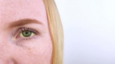 Kadın gözünün sarı rengi. Sarılık, hepatit veya safra kesesi, gastrointestinal ve karaciğer sorunları. Karaciğer, siroz, hepatit ve bilirubin hastalıklarında sarı göz.