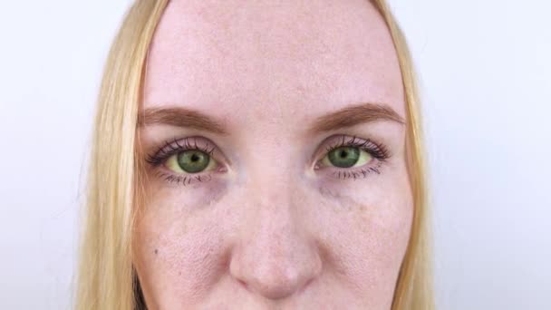 Kadın Gözünün Sarı Rengi Sarılık Hepatit Veya Safra Kesesi Gastrointestinal — Stok video