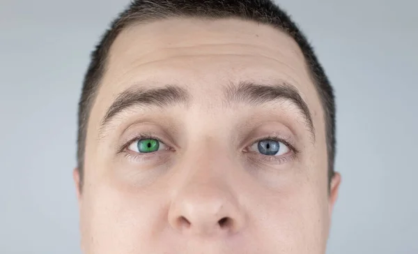 Hombre Con Ojos Diferentes Colores Mira Dentro Del Marco Ojo — Foto de Stock