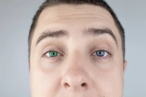 Hombre Con Ojos Diferentes Colores Mira Dentro Del Marco Ojo — Foto de Stock