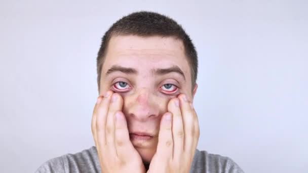 Mężczyzna Pociera Zmęczone Oczy Dłońmi Białe Tło Koncepcja Zmęczenia Oczu — Wideo stockowe