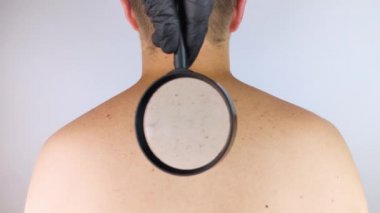 Dermatolog randevusundaki bir adam doğum lekelerini, benlerini ve nevi 'sini gösterir. Doktor dermatoskopla hastayı muayene ediyor. İyi huylu ve kötü huylu doğum lekeleri. Deri anormallikleri bakım konsepti