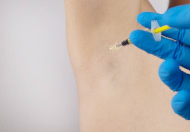 Klinikte hiperhidrozun tedavisi için koltukaltına botoks yapılan bir adam. Artan terleme, anhidroz ya da arızalı bezlerle ilgili sorunların tedavisi. Kozmetolojide Botulinum toksini