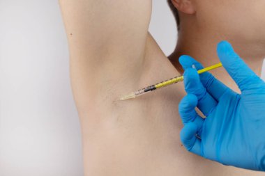 Klinikte hiperhidrozun tedavisi için koltukaltına botoks yapılan bir adam. Artan terleme, anhidroz ya da arızalı bezlerle ilgili sorunların tedavisi. Kozmetolojide Botulinum toksini