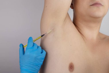 Klinikte hiperhidrozun tedavisi için koltukaltına botoks yapılan bir adam. Artan terleme, anhidroz ya da arızalı bezlerle ilgili sorunların tedavisi. Kozmetolojide Botulinum toksini
