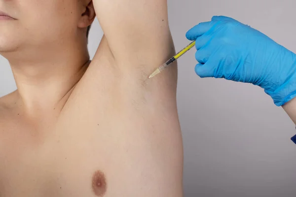 Botox Injekciót Kapó Férfi Hónaljban Hyperhidrosis Kezelésére Klinikán Problémák Kezelése — Stock Fotó