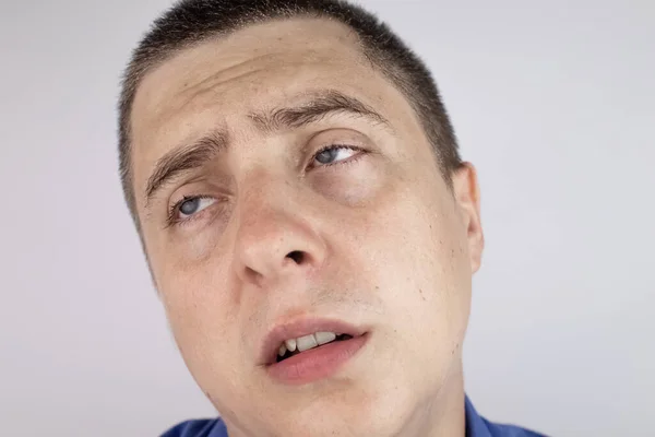 Ein Mann Mit Schweißperlen Gesicht Blickt Die Kamera Schweißdrüsenprobleme Hyperhidrose — Stockfoto