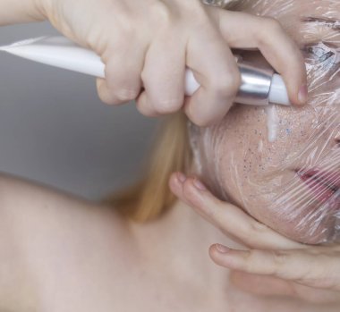 Kozmetik alanında mikroplastikler. Bir kadın cildine bakım kremi sürmüş, şimdi plastik parçacıklar ve mikroboncuklarla kaplanmış. Kozmetik zehirlenmesi konsepti