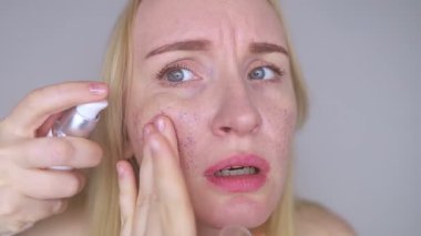 Kozmetik alanında mikroplastikler. Bir kadın cildine bakım kremi sürmüş, şimdi plastik parçacıklar ve mikroboncuklarla kaplanmış. Kozmetik zehirlenmesi konsepti