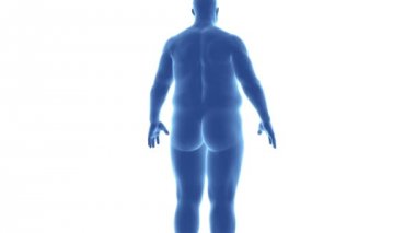 -Obezite ince gelen adam