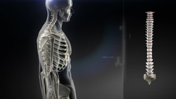 人間の背骨の痛みの概念 — ストック動画