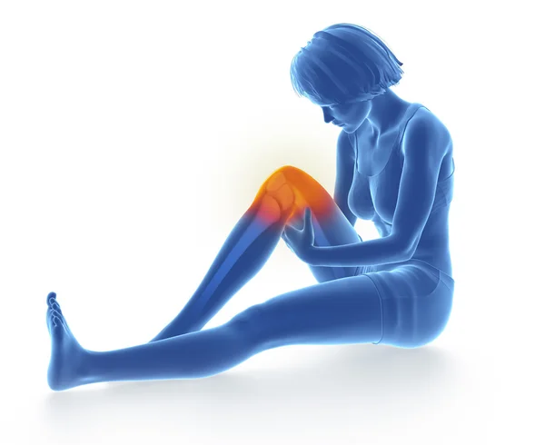 女性の膝を負傷 — ストック写真