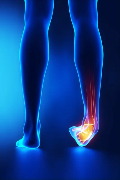 Sprained ankle blue x-ray — Stock Photo, Image