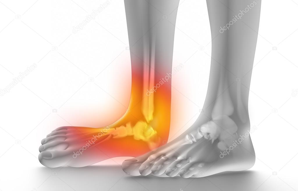 Esguince de tobillo fotografía de stock © CLIPAREA 54887951