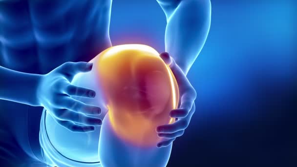 Ból w kolanie — Wideo stockowe