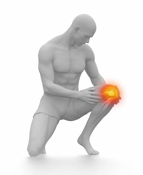 Man with knee injured — Stock Photo, Image