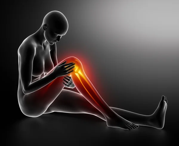 Female knee injured — Stock Photo, Image