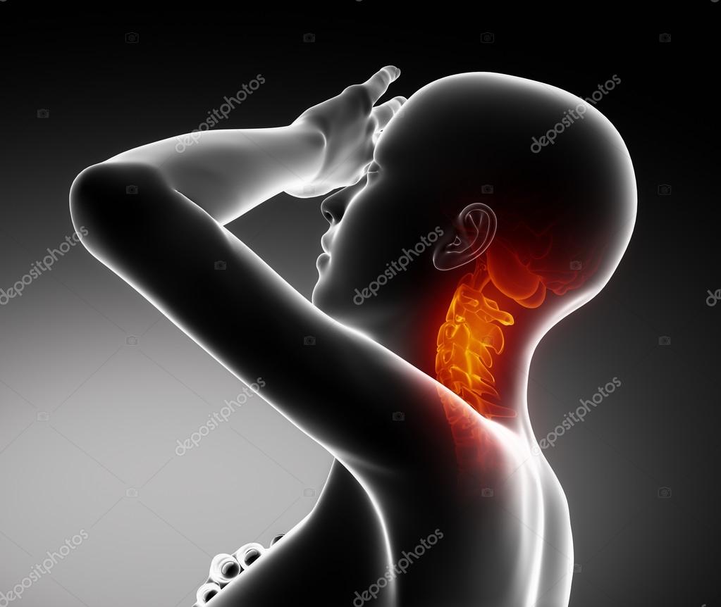 Pain from cervical spine Stock Photo by ©CLIPAREA 60942799