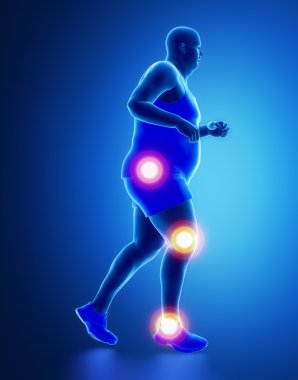 Jogging Obese man with joint problem