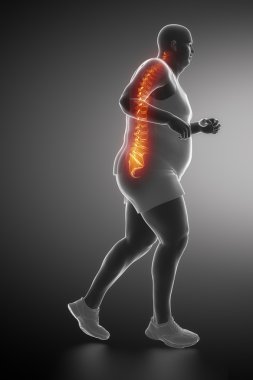 Fat man with backache clipart