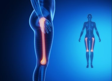 FEMUR x--ray bones scan