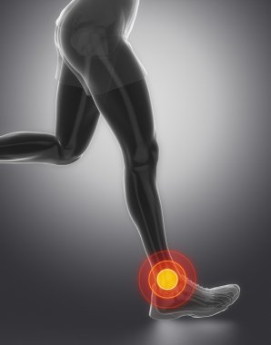 Focused on ankle joint clipart