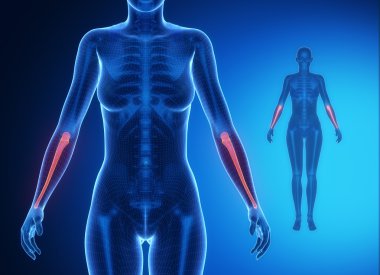 ULNA blue bones scan