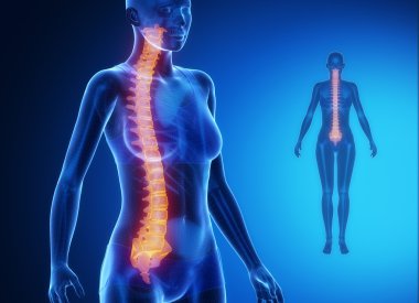Female body with SPINE bone scan clipart