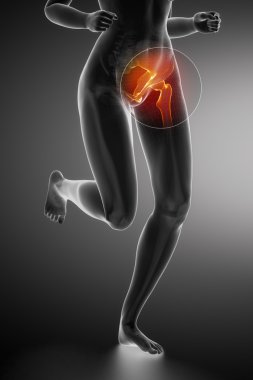 Running woman with hip anatomy clipart
