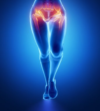 Hip injury in female body clipart