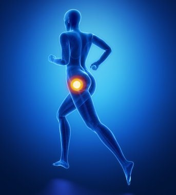 Spor yaralanmaları ile çalışan kadın