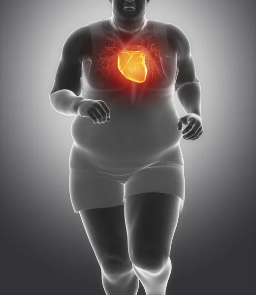 Obese man with heart injury — Stock Photo, Image