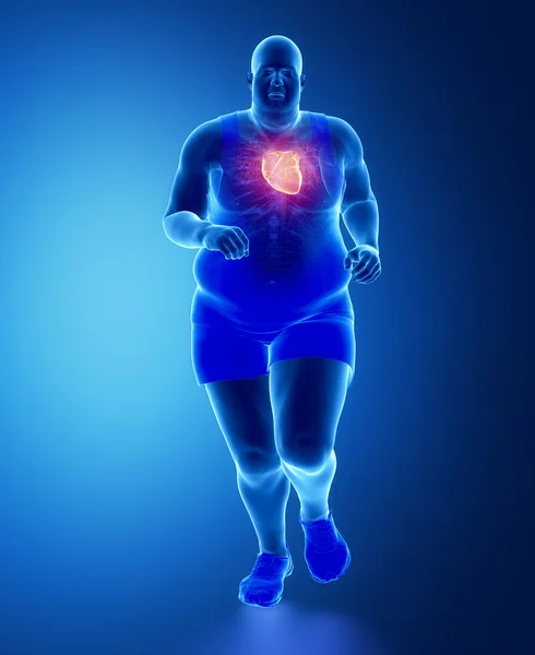 Fat man running with heart attack — Stock Photo, Image