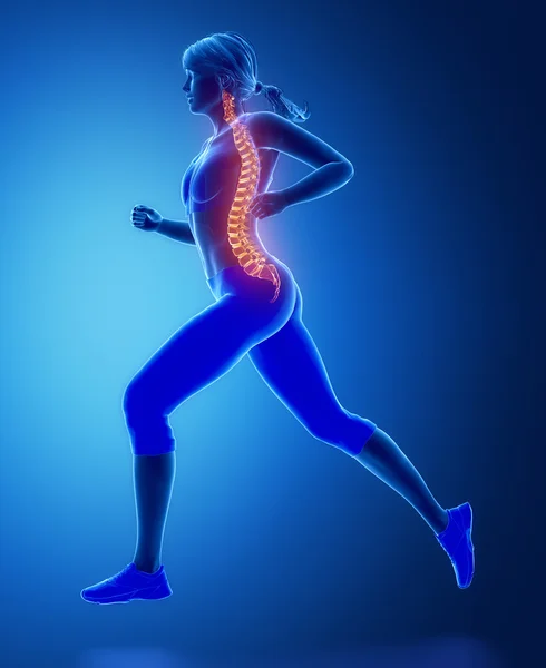 Mujer corriendo con problemas de columna vertebral — Foto de Stock